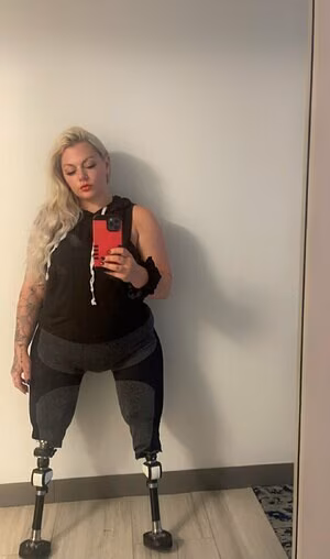 Theamputeebitch's pic #4585616